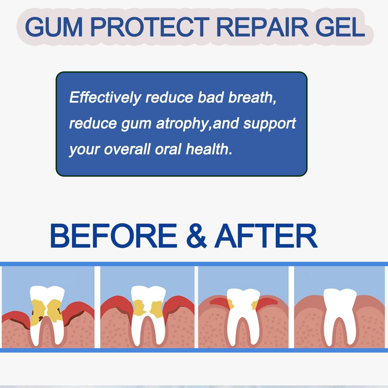 Gum Repair Gel, Gentle Daily Dental Care for Healthy Gums, Mint Flavor, 1 Pack